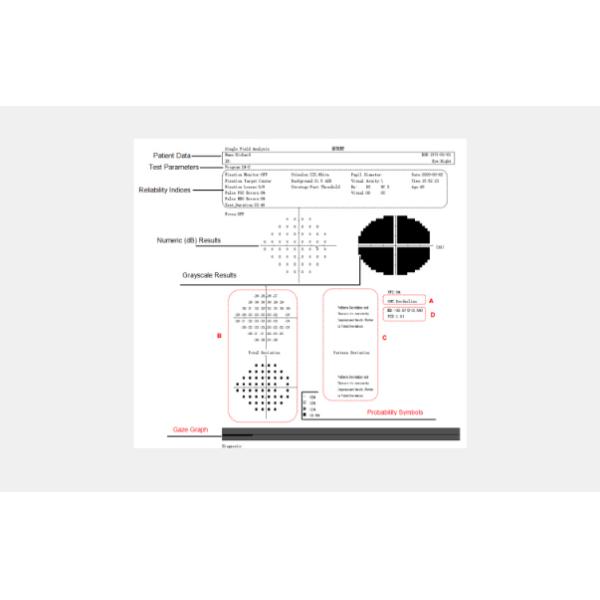Inspection Categories 200ms Visual Field Analyzers International Goldman Standard