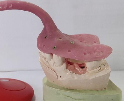 Quality Custom Denture Impression Trays for sale