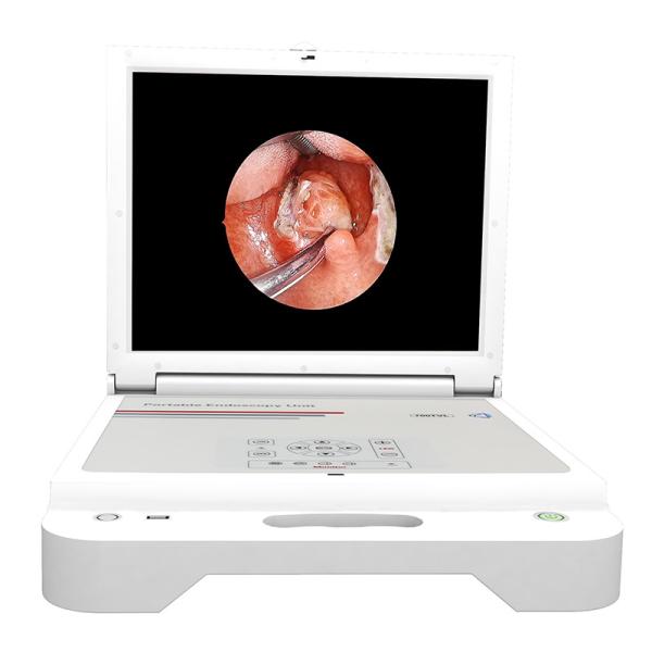 Quality Gynecology ENT Portable Endoscope Camera 17" Mobile for sale