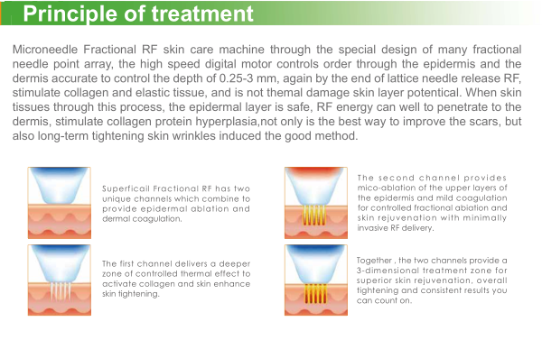 Best discounts fractional rf microneedle machine for face lift