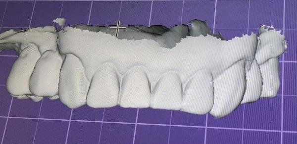 Quality 3D Digital Mock Up Teeth Other Dental Products for sale