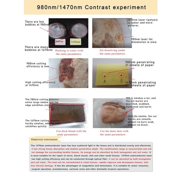 Diode Laser Vascular Removal Machine Endolift Varicose Vein Machine