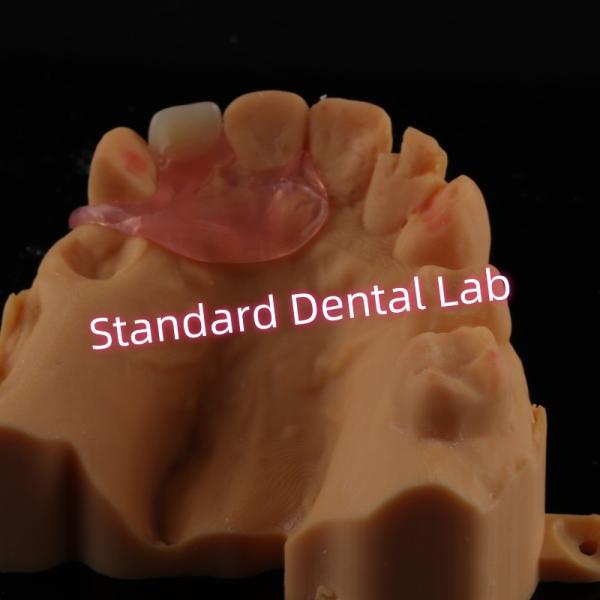 Quality Upper Valplast Unilateral Dentures Removable Flexible One Tooth Partial Teeth for sale