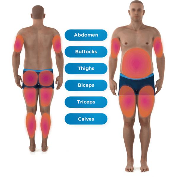 4 Handles Muscle Non-invasive Ems Muscle Stimulator Fat Builds Slimming Rf Body Sculpt Emslim Cellulite Reduction Machine