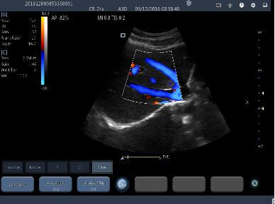 Small Portable Ultrasound Machine Probes With 2~11MHz Frequency 160g Weight Only
