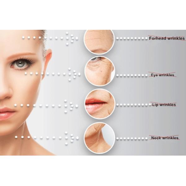 Multifunction E Light Beauty Equipment / E Light Ipl Machine For Tattoo Removal