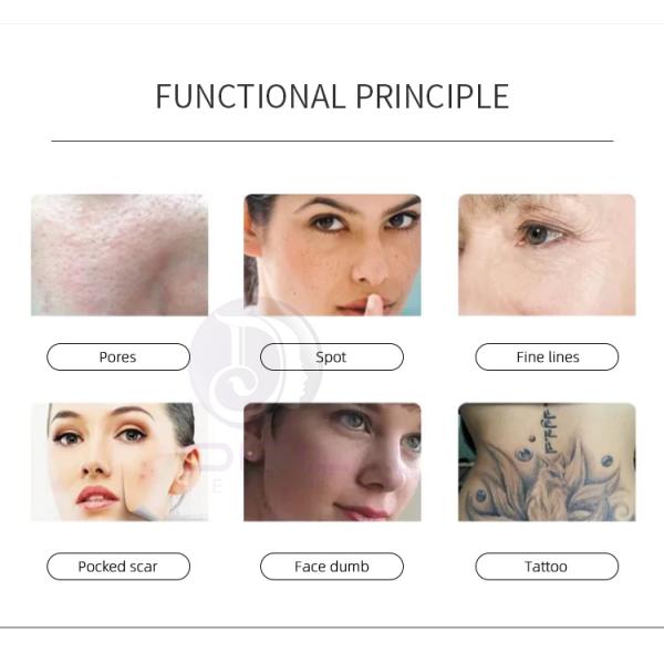 Q Switched Nd Yag Lazer Tattoo Removal Picolaser Carbon Laser Peel Laser Machine For Pigmentation Removal Skin Rejuvenation