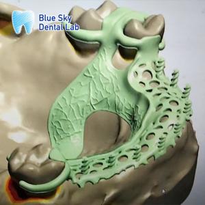 Buy cheap Removable Denture Rpd Framework Design Metal Partial Denture Framework Design product