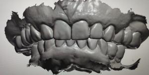 CAD CAM Design Digital Display Mockup Teeth Other Dental Products