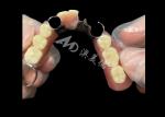 Titantium Cast Partial Dentures With Clasps Rests Along With Teeth Set Up