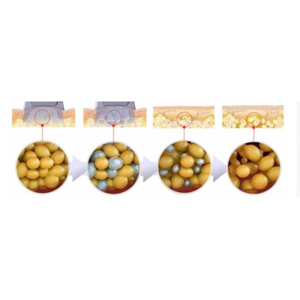 High Safety Cryolipolysis Fat Freezing Machine With 4 Cool Pad Handles