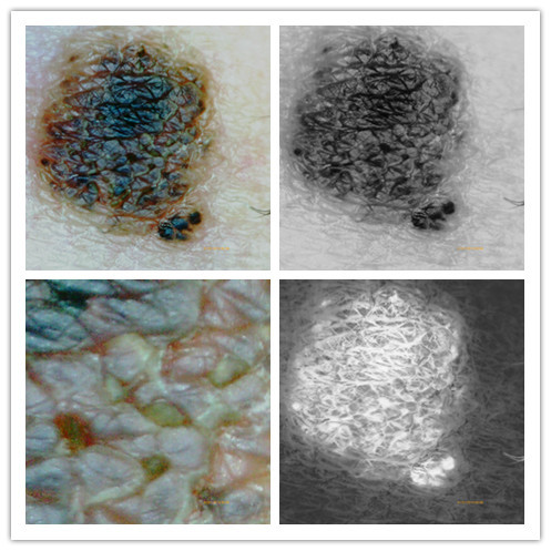 USB Digital Microscope Digital Skin Analyzer With LCD Screen 4032*3024 Resolution Rotated 360º