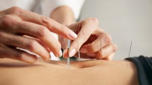 China 0.16mm Silver Intradermal Acupuncture Needles For Pain Relief on sale
