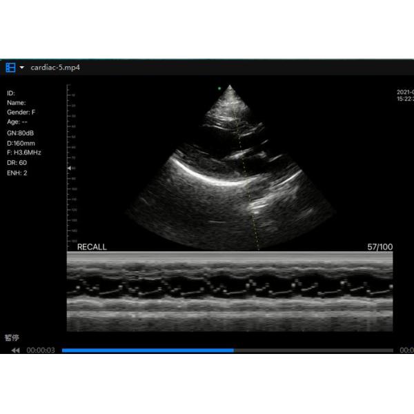 Windows Android Personal Ultrasound Scanner For Home Use 3.6MHz