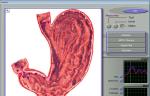 Quantum 3d Nls Health Analyzer , Non-linear Analysis System