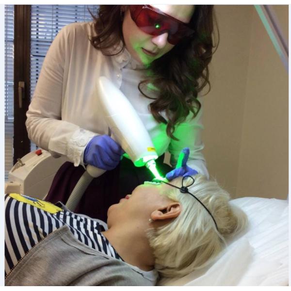 nd yag laser tatoo removal machine