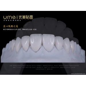 Buy cheap Ultra-thin aesthetic dental veneers product