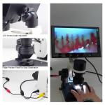 A33.0211 Digital LCD Microscope LCD Microcirculation Checking Microscope