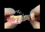 Titantium Cast Partial Dentures With Clasps Rests Along With Teeth Set Up