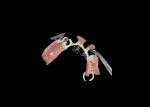 Lightweight and Durable HPP Framework Partial Dentures The Perfect Blend of