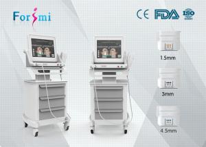 China portable radio frequency hifu face lift device wrinkle removal machine for sale on sale