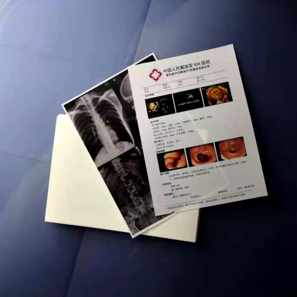 A4 White Glossy Medical Dry Film Laser Inkjet X Ray Film 150 Microns