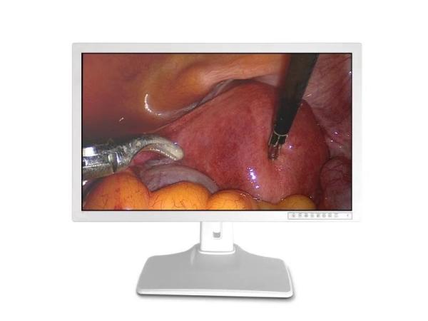 Quality HDMI VGA Medical Display 32 Inch 4k Monitor for sale