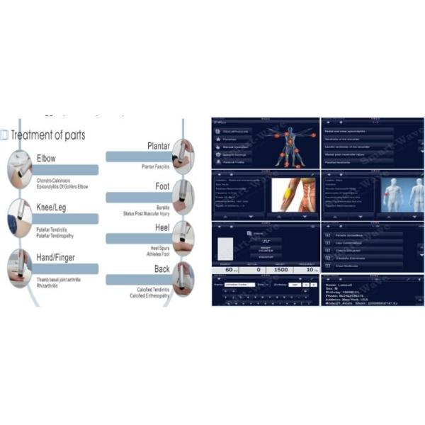 Radial ESWT Shockwave Therapy Machine Treatment For Heel Pain Adjustable Frequency