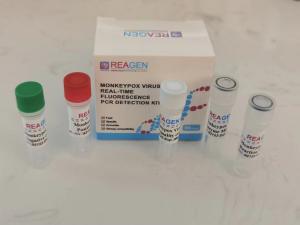 Real Time Fluorescence In Vitro Diagnostic Products PCR Detection Kit
