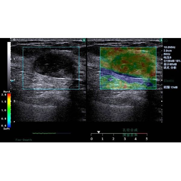 Healthcare Trolley Ultrasound Scanner System Clear Image Stable Performance