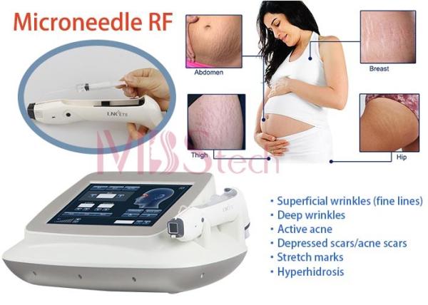 Quality Stretch Marks Removal Face Lifting Rf Microneedle Machine for sale