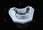 Sensitive Skin High Strength Titanium Framework Solution 3D Printed