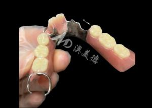 Buy cheap Titantium Cast Partial Dentures With Clasps Rests Along With Teeth Set Up product