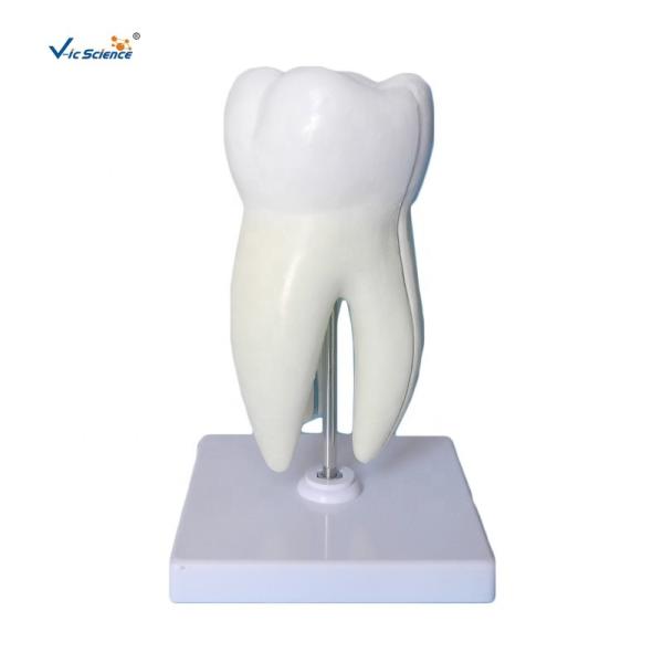 Quality Teeth Anatomical Model Molar Tooth Attach With Caries Maxillary 3 Roots Magnify for sale
