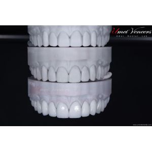 Super Natural Hollywood Veneers
