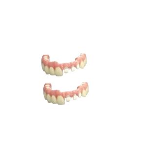 Resin-Based CAD-CAM Fixed Removable Bridge Aesthetics Restoration