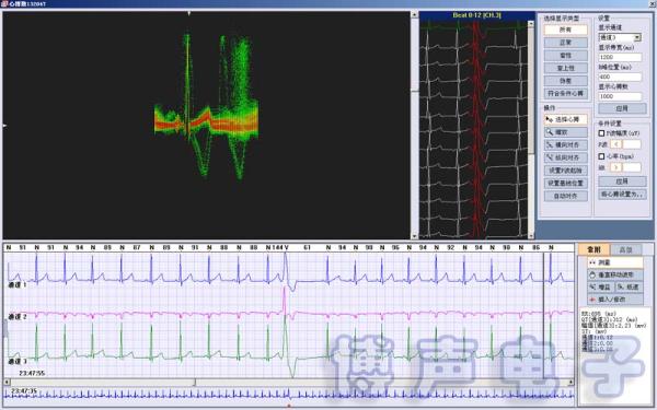 Quality iTengo+ Holter ECG Analysis Software System Workstation Holter Monitor for sale