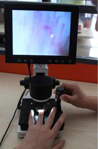 Quality High Definition LCD Microcirculation Checking Microscope Nailfold Video Detection Instrument for sale