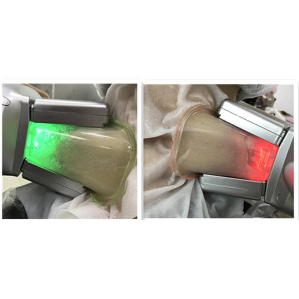 Cryolipolysis Fat Freezing Machine Cryo Lipolysis device With Double Chin handle