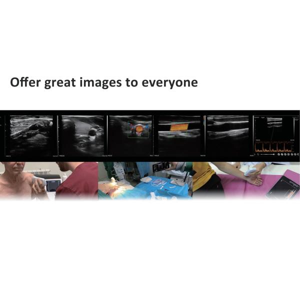 10mhz G10CX Medical Hospital Equipments Doppler Linear Wireless Probe Type Ultrasound Scanner