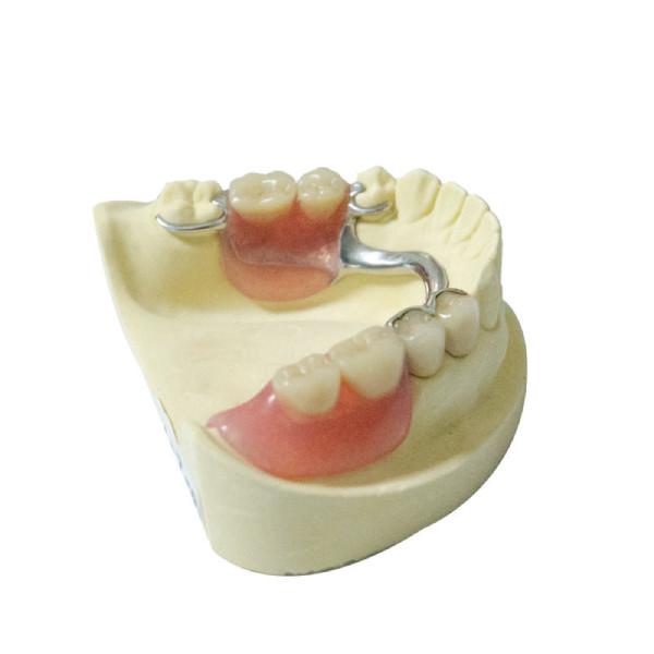 Quality Healthy Materials Denture Dental Lab Removable Partial Dentures custom made for sale