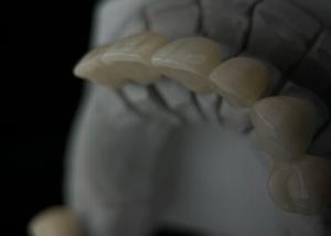 Fit Monolithic Zirconia Tooth Crown With Translucency And Resistance
