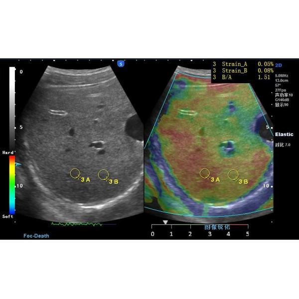 Healthcare Trolley Ultrasound Scanner System Clear Image Stable Performance