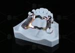 Sensitive Skin High Strength Titanium Framework Solution 3D Printed