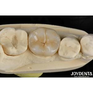 Buy cheap Adhesive Cementation Zirconia Dental Inlays And Onlays Natural Looking product