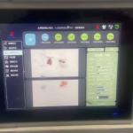 Walnut Kernel Sorting Machine AI-Powered Industrial-Grade Stability Real-Time