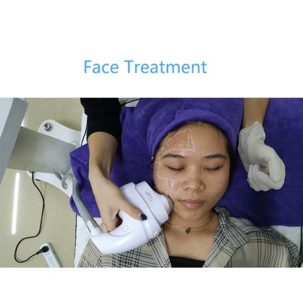 Anti Aging Body Slimming ICE Non Invasive 5D Hifu Machine