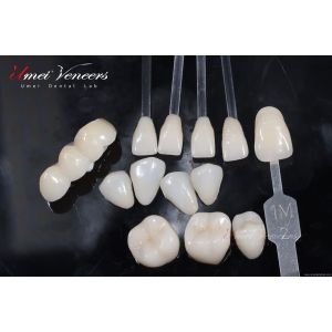 Buy cheap Natural White Cast Porcelain Veneers product