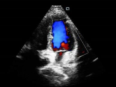 Small Portable Ultrasound Machine Probes With 2~11MHz Frequency 160g Weight Only