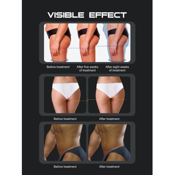 Ems Emt Teslaslim Body Sculpt Shaping Machine Ems Slimming Electro Stimulator